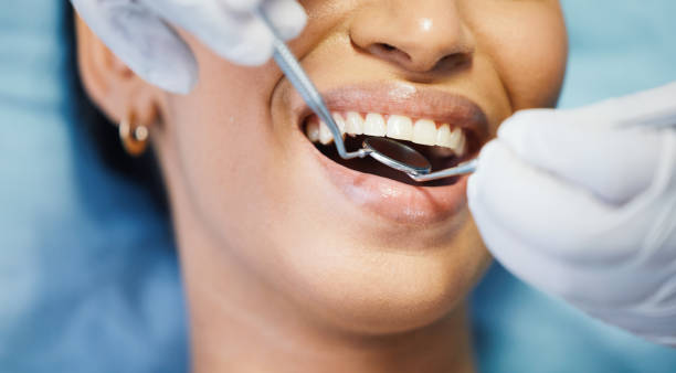 Dental Bonding in Jessup, PA